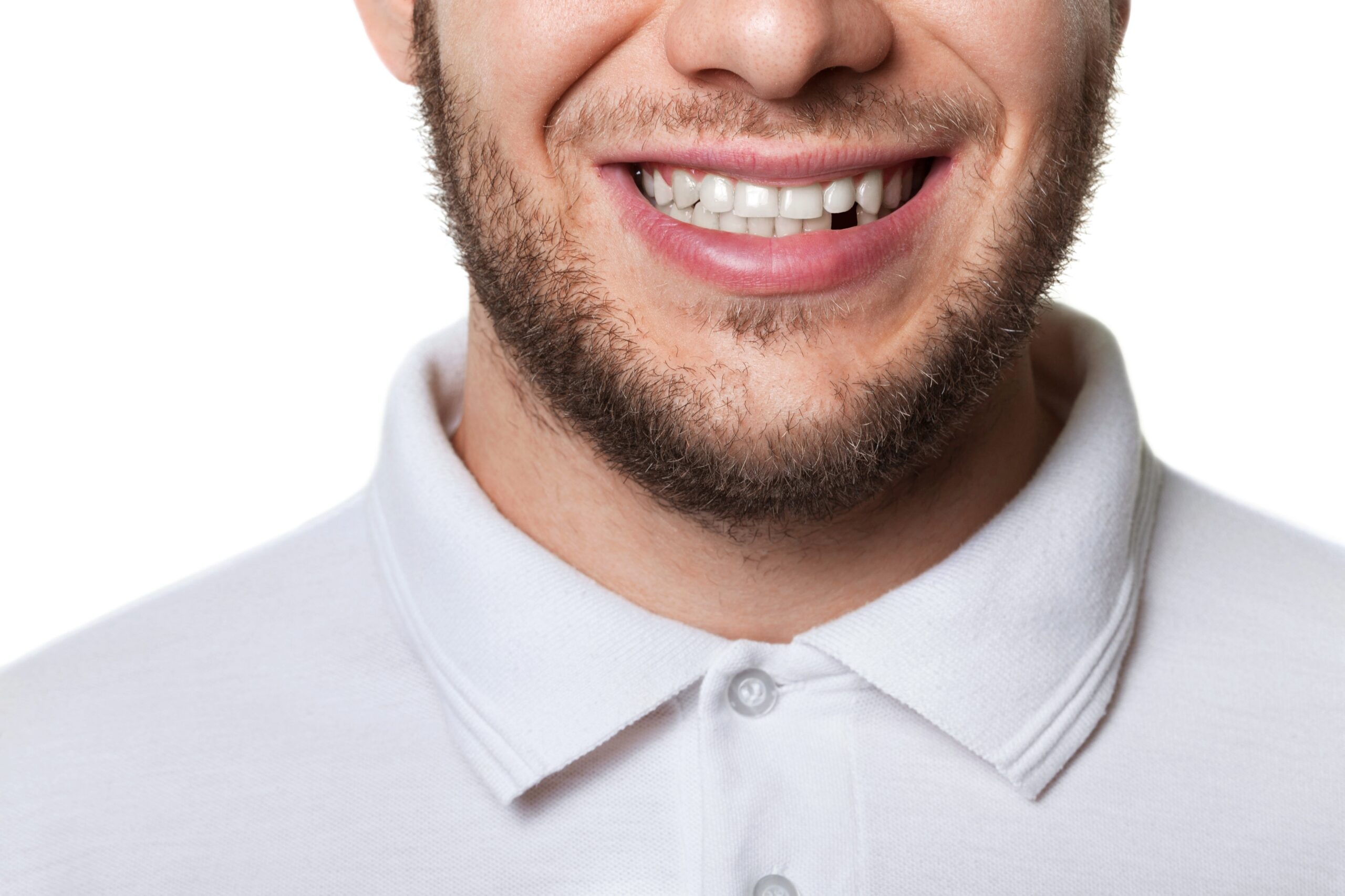 4 Reasons to Replace Missing Teeth