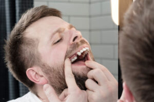 Dental Patient Missing His Top Right Premolar