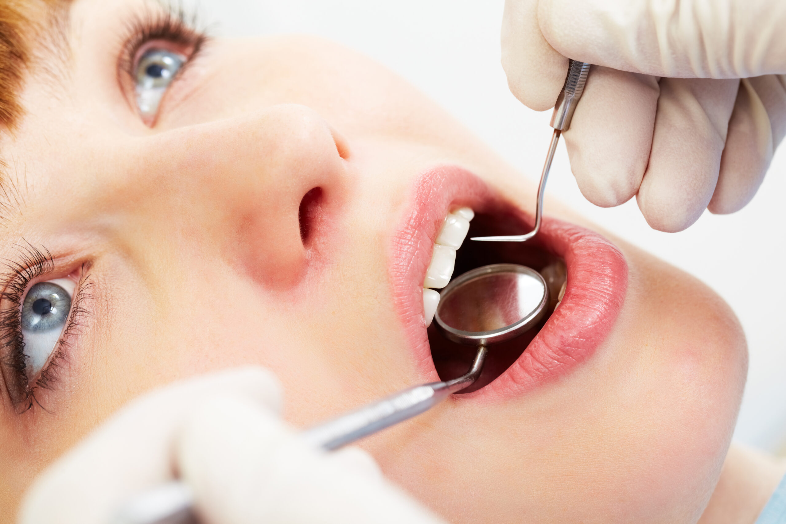An image of a dental patient getting treated for Scaling And Root Planing Procedures
